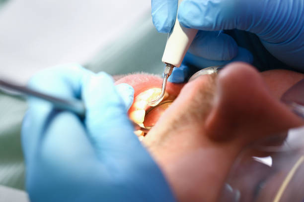 Best Walk-In Emergency Dentist in Fergus Falls, MN